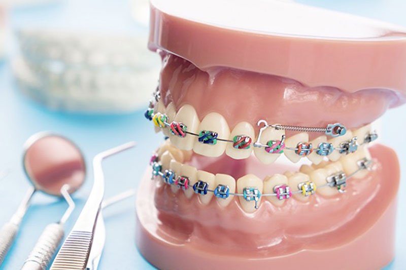 Orthodontic Assistant Training